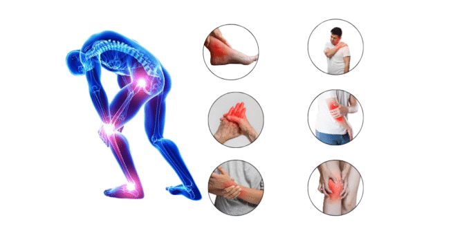 Joint Pain Management